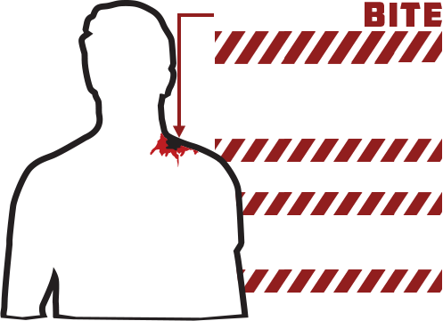 zombie bite, can cause infection quarantine a whole load of zombie gore